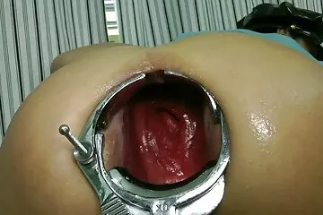 Em gái gợi cảm phim xx phá trinh bị mổ nhẹ trong cận cảnh âm đạo.