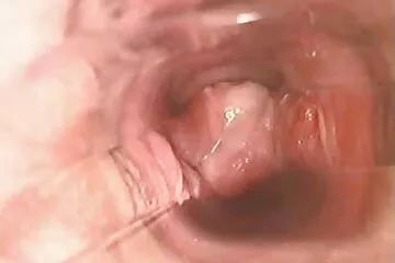 Em gái ngực to phim xx hàn quốc cắt lông mu không có gì phản đối tình dục mà chỉ ở tư thế truyền giáo.